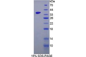 Image no. 1 for serine/arginine-Rich Protein Specific Kinase 3 (SRPK3) (AA 220-506) protein (T7 tag,His tag) (ABIN6238317)