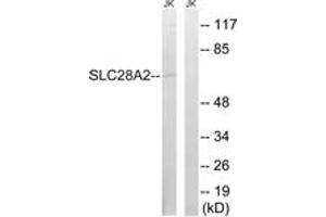 Image no. 1 for anti-Solute Carrier Family 28 (Sodium-Coupled Nucleoside Transporter), Member 2 (SLC28A2) (AA 371-420) antibody (ABIN1535385)