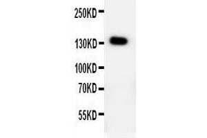 anti-Patched 2 (PTCH2) (AA 885-901), (C-Term) antibody