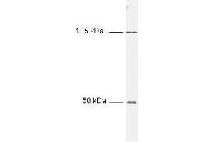 Image no. 2 for anti-Nuclear Factor kappa B (NFkB) antibody (ABIN965403)