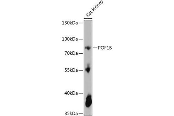 POF1B antibody  (AA 330-560)