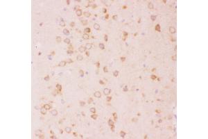 Image no. 1 for anti-Tuberous Sclerosis 2 (TSC2) (AA 1611-1807) antibody (ABIN3043498)