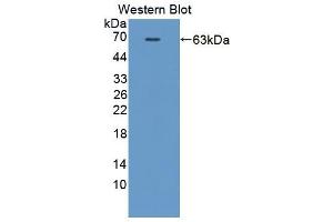 Image no. 1 for anti-Hemopoietic Cell Kinase (HCK) (AA 2-524) antibody (ABIN5013688)