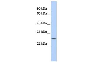 Image no. 1 for anti-F-Box Protein 22 (FBXO22) (Middle Region) antibody (ABIN632326)