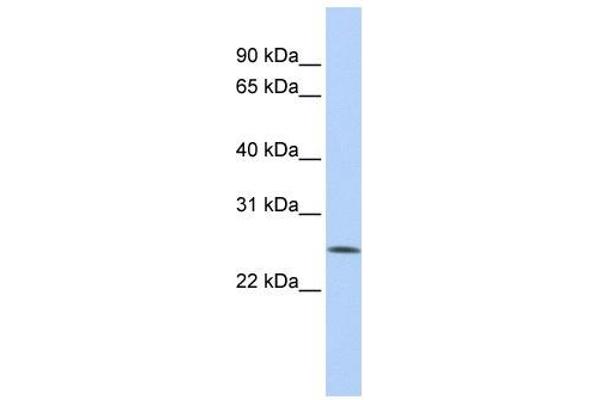 anti-F-Box Protein 22 (FBXO22) (Middle Region) antibody