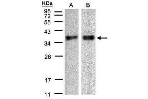 anti-Zona Pellucida Binding Protein (ZPBP) (Center) antibody