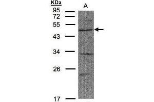 WB Image Sample(30 μg of whole cell lysate) A:A431, 10% SDS PAGE antibody diluted at 1:1500