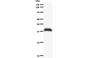 Image no. 1 for anti-SWI/SNF Related, Matrix Associated, Actin Dependent Regulator of Chromatin, Subfamily A, Member 4 (SMARCA4) antibody (ABIN930944)