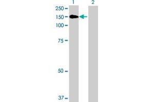 Image no. 1 for anti-TAO Kinase 3 (TAOK3) (AA 1-898) antibody (ABIN526654)