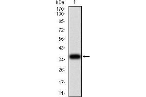 Image no. 3 for anti-Uncoupling Protein 2 (Mitochondrial, Proton Carrier) (UCP2) (AA 1-309) antibody (ABIN5888560)