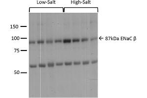 Image no. 4 for anti-Sodium Channel, Nonvoltage-Gated 1, beta (SCNN1B) (AA 617-638) antibody (PerCP) (ABIN2486414)