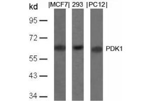 Image no. 4 for anti-3-phosphoinositide Dependent Protein Kinase-1 (PDPK1) (Ser241) antibody (ABIN197100)