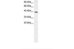 Image no. 2 for anti-Forkhead Box F2 (FOXF2) (AA 52-101) antibody (ABIN202540)