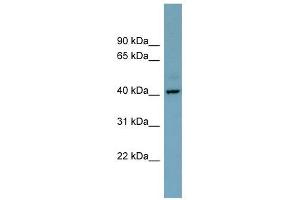 Image no. 1 for anti-Chromosome X Open Reading Frame 66 (CXorf66) (Middle Region) antibody (ABIN635057)
