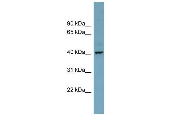 anti-Chromosome X Open Reading Frame 66 (CXorf66) (Middle Region) antibody