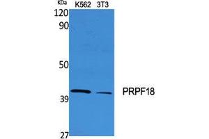 Image no. 2 for anti-PRP18 Pre-mRNA Processing Factor 18 (PRPF18) (Internal Region) antibody (ABIN3186566)