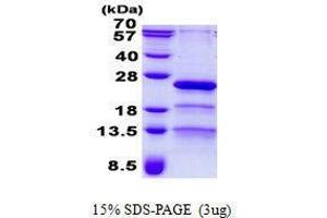 Image no. 1 for Retinitis Pigmentosa 9 (Autosomal Dominant) (RP9) protein (ABIN2131597)