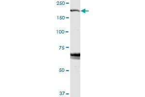 Image no. 3 for anti-Zinc Finger, FYVE Domain Containing 9 (ZFYVE9) (AA 1-762) antibody (ABIN948795)