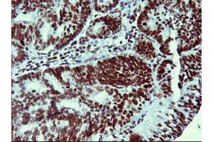 Image no. 1 for anti-Tumor Protein P73 (TP73) (AA 167-409) antibody (ABIN1491005)