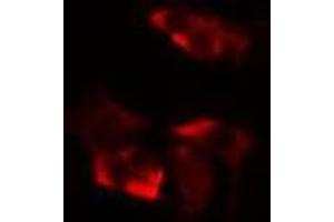 Image no. 2 for anti-X-Ray Repair Complementing Defective Repair in Chinese Hamster Cells 3 (XRCC3) antibody (ABIN6266069)