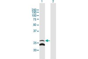 Western Blot analysis of GADD45GIP1 expression in transfected 293T cell line by GADD45GIP1 MaxPab polyclonal antibody.