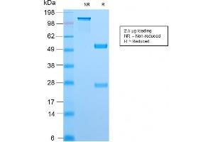 Image no. 1 for anti-Topoisomerase (DNA) I, Mitochondrial (TOP1MT) antibody (ABIN6939149)