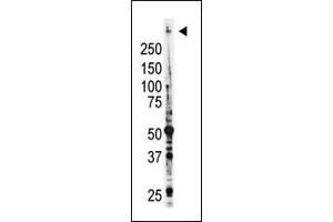 Image no. 2 for anti-Myeloid/lymphoid Or Mixed-Lineage Leukemia (MLL) (C-Term) antibody (ABIN356674)