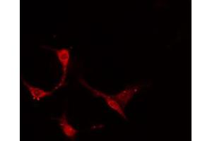 Image no. 1 for anti-Tumor-Associated Calcium Signal Transducer 2 (TACSTD2) antibody (ABIN6259163)