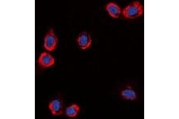 anti-G Protein-Coupled Receptor 87 (GPR87) antibody