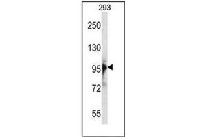Image no. 1 for anti-RNA Binding Motif Protein 10 (RBM10) (AA 84-113), (N-Term) antibody (ABIN954474)