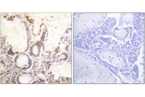 Immunohistochemistry analysis of paraffin-embedded human placenta, using GTPase Activating Protein (Phospho-Ser387) Antibody.