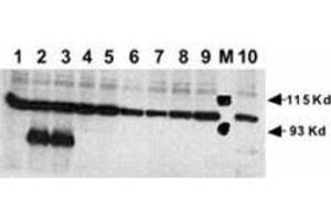 Image no. 4 for anti-Notch 1 (NOTCH1) (N-Term) antibody (ABIN104897)