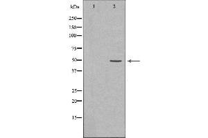 Image no. 3 for anti-Inhibitor of kappa Light Polypeptide Gene Enhancer in B-Cells, Kinase gamma (IKBKG) (N-Term) antibody (ABIN6262510)