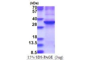 Image no. 1 for Zinc Finger Protein 32 (ZNF32) (AA 1-273) protein (His tag) (ABIN5853740)