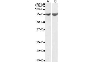Image no. 1 for anti-Mitogen-Activated Protein Kinase 8 Interacting Protein 1 (MAPK8IP1) (AA 265-279) antibody (ABIN6391395)
