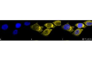Image no. 1 for anti-Superoxide Dismutase 2, Mitochondrial (SOD2) antibody (FITC) (ABIN2484765)