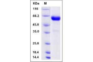 Image no. 1 for Chondrolectin (CHODL) (AA 1-216) protein (Fc Tag) (ABIN2009580)
