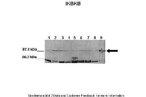 Image no. 3 for anti-Inhibitor of kappa Light Polypeptide Gene Enhancer in B-Cells, Kinase beta (IKBKB) (N-Term) antibody (ABIN2779787)