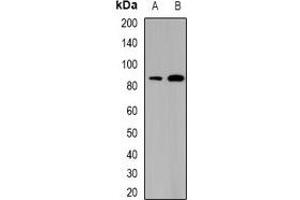 Image no. 3 for anti-SATB Homeobox 1 (SATB1) antibody (ABIN2967007)