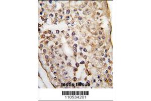 Image no. 2 for anti-Pumilio Homolog 2 (Drosophila) (PUM2) (AA 133-162), (N-Term) antibody (ABIN391821)