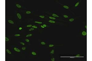 Immunofluorescence of purified MaxPab antibody to HNRNPUL1 on HeLa cell.