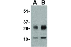 Image no. 1 for anti-SCO1 Cytochrome C Oxidase Assembly Protein (SCO1) (Internal Region) antibody (ABIN6657304)