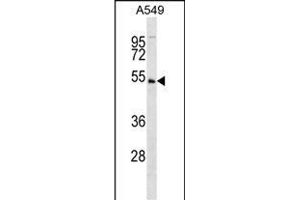 UHMK1 anticorps  (N-Term)