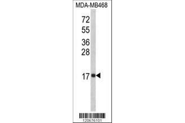 anti-Interleukin 8 (IL8) (AA 72-99), (C-Term) antibody