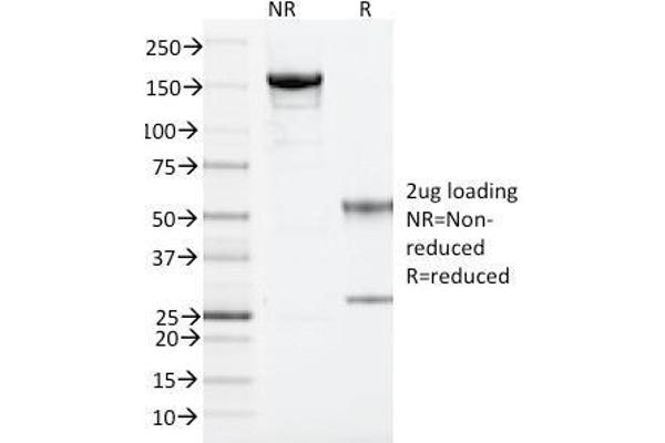 anti-ADP-Ribosylation Factor 1 (ARF1) antibody