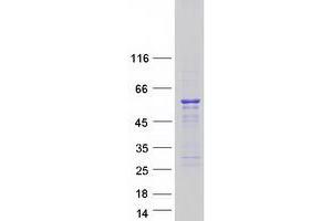 Image no. 1 for Src Kinase Associated phosphoprotein 1 (SKAP1) (Transcript Variant 2) protein (Myc-DYKDDDDK Tag) (ABIN2731440)