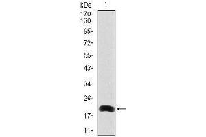 Image no. 1 for anti-Low Density Lipoprotein Receptor-Related Protein 5 (LRP5) antibody (ABIN969535)