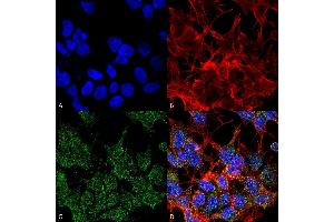 Immunocytochemistry/Immunofluorescence analysis using Mouse Anti-VGLUT2 Monoclonal Antibody, Clone S29-29 (ABIN1027711).