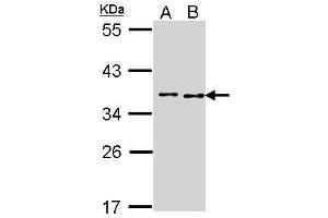 Image no. 3 for anti-BRCA2 and CDKN1A Interacting Protein (BCCIP) (C-Term) antibody (ABIN2856892)