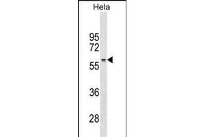 RRP1 Antibody (Center) (ABIN1538269 and ABIN2838098) western blot analysis in Hela cell line lysates (35 μg/lane).